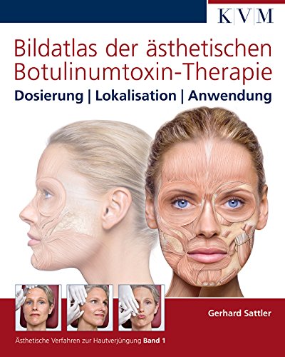 Bildatlas der ästhetischen Botulinumtoxin-Therapie: Dosierung, Lokalisation, Anwendung