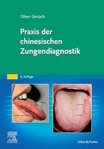 Praxis der chinesischen Zungendiagnostik: Vom Zungenbild zum Behandlungsplan und das Zungenbild im Therapieverlauf Praxis der chinesischen Zungendiagnostik: Vom Zungenbild zum Behandlungsplan und das Zungenbild im Therapieverlauf