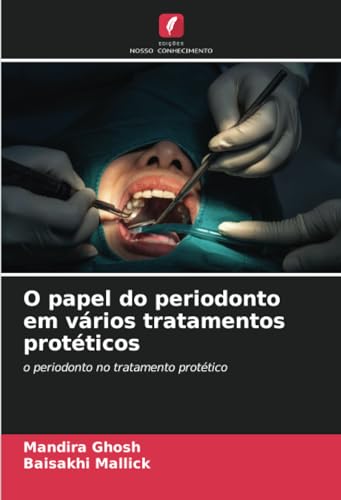 O papel do periodonto em vários tratamentos protéticos: o periodonto no tratamento protético von Edições Nosso Conhecimento