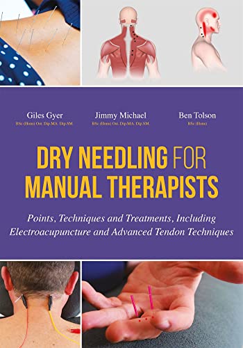 Dry Needling for Manual Therapists: Points, Techniques and Treatments, Including Electroacupuncture and Advanced Tendon Techniques: Points, Techniques ... Electroacupuncture and Advanced Techniques von Singing Dragon