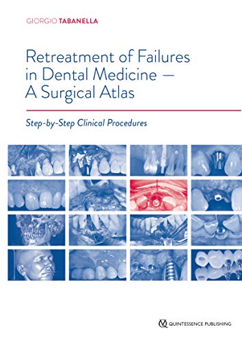 Retreatment of Failures in Dental Medicine - A Surgical Atlas: Step-by-Step Clinical Procedures Retreatment of Failures in Dental Medicine - A Surgical Atlas: Step-by-Step Clinical Procedures von Quintessence Publishing