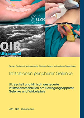 Infiltrationen peripherer Gelenke: Ultraschall und klinisch gesteuerte Infiltrationstechniken am Bewegungsapparat - Gelenke und Wirbelsäule Infiltrationen peripherer Gelenke: Ultraschall und klinisch gesteuerte Infiltrationstechniken am Bewegungsapparat - Gelenke und Wirbelsäule