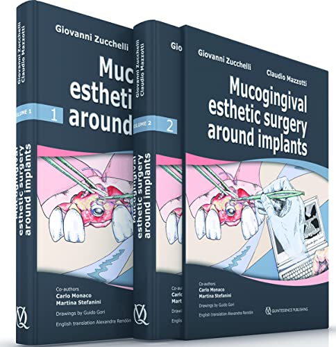 Mucogingival Esthetic Surgery around Implants von Quintessence Publishing