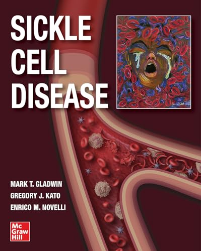 Sickle Cell Disease von McGraw-Hill Education