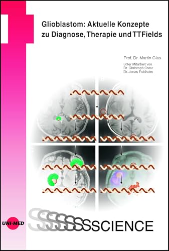 Glioblastom: Aktuelle Konzepte zu Diagnose, Therapie und TTFields (UNI-MED Science) von UNI-MED