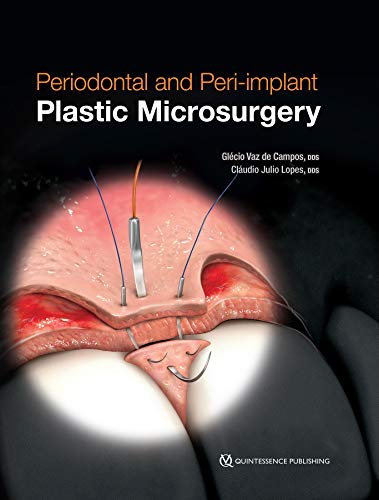 Periodontal and Peri‑implant Plastic Microsurgery: Minimally Invasive Techniques with Maximum Precision