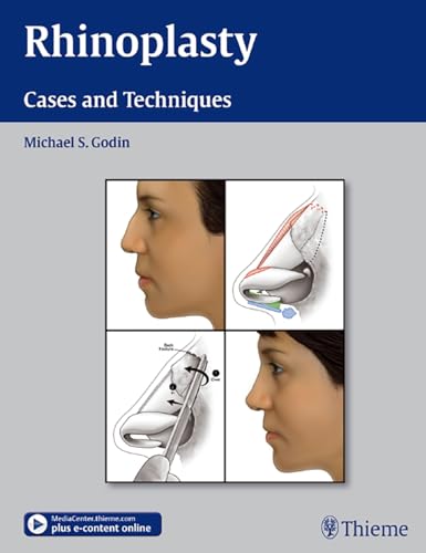 Rhinoplasty - Cases and Techniques: Cases and Techniques