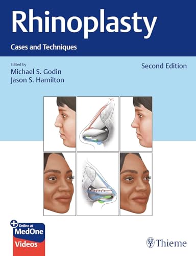 Rhinoplasty: Cases and Techniques Rhinoplasty: Cases and Techniques von Thieme Publishers New York