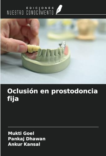 Oclusión en prostodoncia fija von Ediciones Nuestro Conocimiento