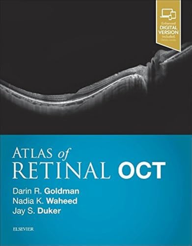 Atlas of Retinal OCT: Optical Coherence Tomography von Elsevier