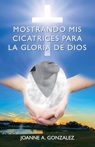 Mostrando Mis Cicatrices Para La Gloria De Dios von Spines