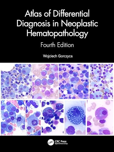 Atlas of Differential Diagnosis in Neoplastic Hematopathology von CRC Press