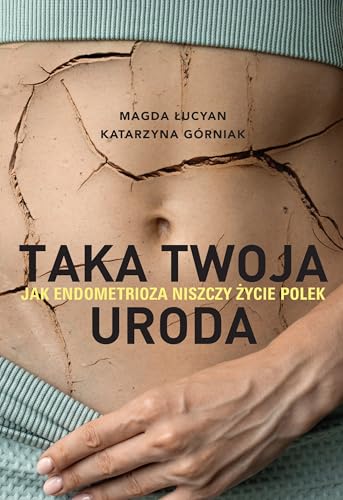 Taka twoja uroda. Jak endometrioza niszczy życie Polek: Taka twoja uroda. Jak endometrioza niszczy życie Polek von Znak
