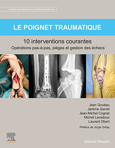 Le poignet traumatique 10 interventions courantes: Manuel de chirurgie du membre supérieur von MASSON