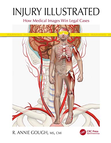 Injury Illustrated: How Medical Images Win Legal Cases von CRC Press