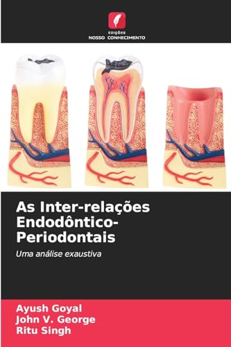 As Inter-relações Endodôntico-Periodontais: Uma análise exaustiva As Inter-relações Endodôntico-Periodontais: Uma análise exaustiva von Edições Nosso Conhecimento