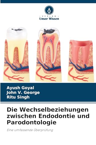 Die Wechselbeziehungen zwischen Endodontie und Parodontologie: Eine umfassende Überprüfung von Verlag Unser Wissen
