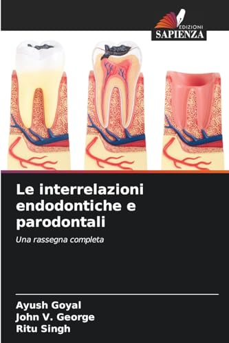 Le interrelazioni endodontiche e parodontali: Una rassegna completa von Edizioni Sapienza