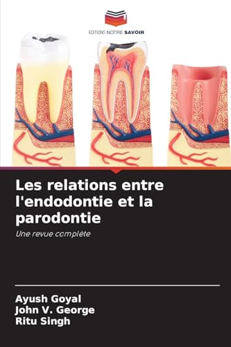 Les relations entre l'endodontie et la parodontie: Une revue complète von Editions Notre Savoir