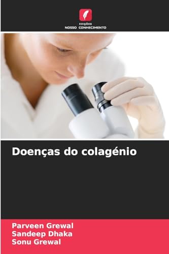 Doenças do colagénio von Edições Nosso Conhecimento