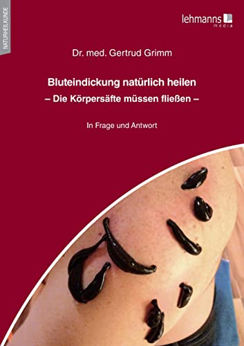 Bluteindickung natürlich heilen: Die Körpersäfte müssen fließen
