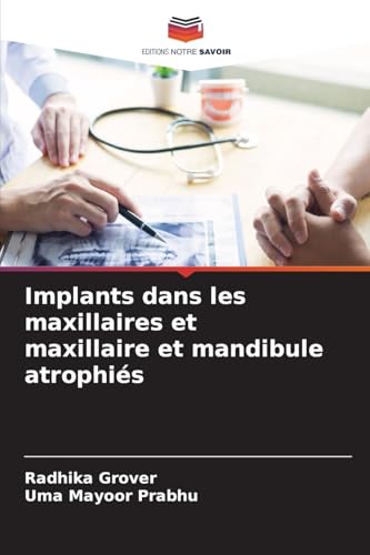 Implants dans les maxillaires et maxillaire et mandibule atrophiés: DE von Editions Notre Savoir
