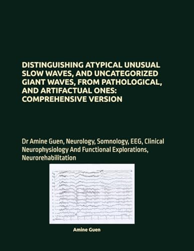 DISTINGUISHING ATYPICAL UNUSUAL SLOW WAVES, AND UNCATEGORIZED GIANT WAVES, FROM PATHOLOGICAL, AND ARTIFACTUAL ONES: COMPREHENSIVE VERSION: Dr Amine ... Functional Explorations, Neurorehabilitation DISTINGUISHING ATYPICAL UNUSUAL SLOW WAVES, AND UNCATEGORIZED GIANT WAVES, FROM PATHOLOGICAL, AND ARTIFACTUAL ONES: COMPREHENSIVE VERSION: Dr Amine ... Functional Explorations, Neurorehabilitation von Independently published
