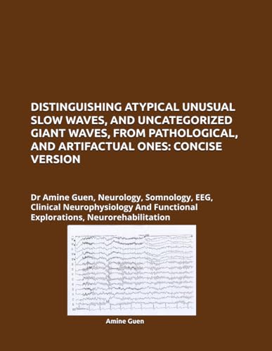 DISTINGUISHING ATYPICAL UNUSUAL SLOW WAVES, AND UNCATEGORIZED GIANT WAVES, FROM PATHOLOGICAL, AND ARTIFACTUAL ONES: CONCISE VERSION: Dr Amine Guen, ... Functional Explorations, Neurorehabilitation DISTINGUISHING ATYPICAL UNUSUAL SLOW WAVES, AND UNCATEGORIZED GIANT WAVES, FROM PATHOLOGICAL, AND ARTIFACTUAL ONES: CONCISE VERSION: Dr Amine Guen, ... Functional Explorations, Neurorehabilitation von Independently published