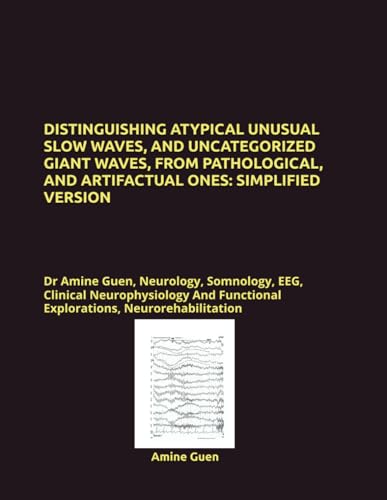 DISTINGUISHING ATYPICAL UNUSUAL SLOW WAVES, AND UNCATEGORIZED GIANT WAVES, FROM PATHOLOGICAL, AND ARTIFACTUAL ONES: SIMPLIFIED VERSION: Dr Amine Guen, ... Functional Explorations, Neurorehabilitation DISTINGUISHING ATYPICAL UNUSUAL SLOW WAVES, AND UNCATEGORIZED GIANT WAVES, FROM PATHOLOGICAL, AND ARTIFACTUAL ONES: SIMPLIFIED VERSION: Dr Amine Guen, ... Functional Explorations, Neurorehabilitation von Independently published