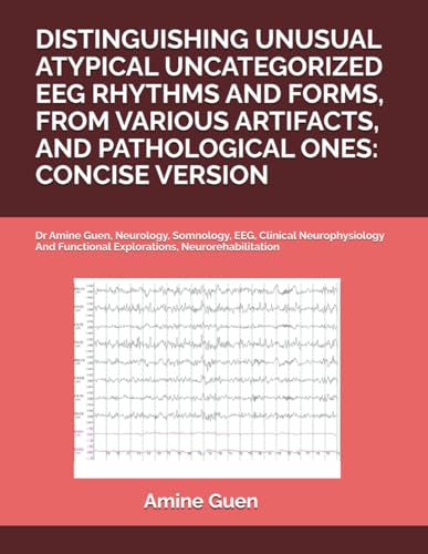 DISTINGUISHING UNUSUAL ATYPICAL UNCATEGORIZED EEG RHYTHMS AND FORMS, FROM VARIOUS ARTIFACTS, AND PATHOLOGICAL ONES: CONCISE VERSION: Dr Amine Guen, ... Functional Explorations, Neurorehabilitation DISTINGUISHING UNUSUAL ATYPICAL UNCATEGORIZED EEG RHYTHMS AND FORMS, FROM VARIOUS ARTIFACTS, AND PATHOLOGICAL ONES: CONCISE VERSION: Dr Amine Guen, ... Functional Explorations, Neurorehabilitation