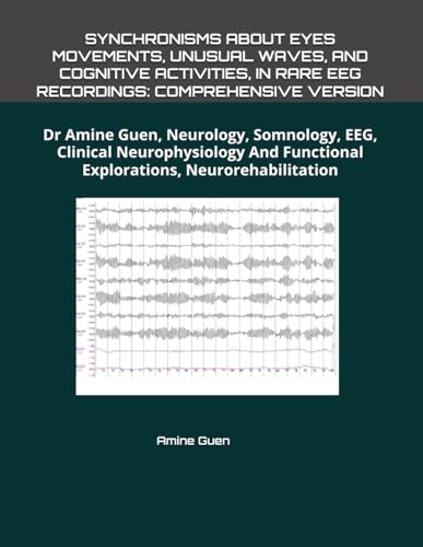 SYNCHRONISMS ABOUT EYES MOVEMENTS, UNUSUAL WAVES, AND COGNITIVE ACTIVITIES, IN RARE EEG RECORDINGS: COMPREHENSIVE VERSION: Dr Amine Guen, Neurology, ... Functional Explorations, Neurorehabilitation SYNCHRONISMS ABOUT EYES MOVEMENTS, UNUSUAL WAVES, AND COGNITIVE ACTIVITIES, IN RARE EEG RECORDINGS: COMPREHENSIVE VERSION: Dr Amine Guen, Neurology, ... Functional Explorations, Neurorehabilitation von Independently published