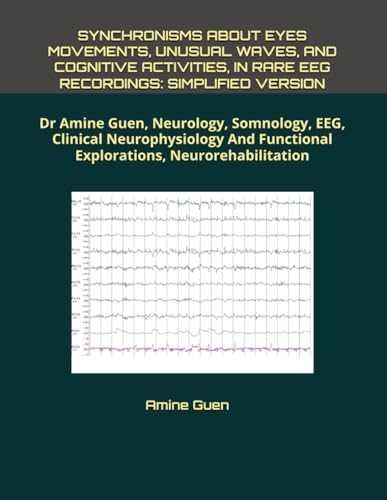 SYNCHRONISMS ABOUT EYES MOVEMENTS, UNUSUAL WAVES, AND COGNITIVE ACTIVITIES, IN RARE EEG RECORDINGS: SIMPLIFIED VERSION: Dr Amine Guen, Neurology, ... Functional Explorations, Neurorehabilitation SYNCHRONISMS ABOUT EYES MOVEMENTS, UNUSUAL WAVES, AND COGNITIVE ACTIVITIES, IN RARE EEG RECORDINGS: SIMPLIFIED VERSION: Dr Amine Guen, Neurology, ... Functional Explorations, Neurorehabilitation von Independently published