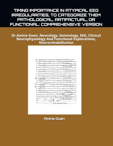 TIMING IMPORTANCE IN ATYPICAL EEG IRREGULARITIES, TO CATEGORIZE THEM PATHOLOGICAL, ARTIFACTUAL, OR FUNCTIONAL: COMPREHENSIVE VERSION: Dr Amine Guen, ... Functional Explorations, Neurorehabilitation TIMING IMPORTANCE IN ATYPICAL EEG IRREGULARITIES, TO CATEGORIZE THEM PATHOLOGICAL, ARTIFACTUAL, OR FUNCTIONAL: COMPREHENSIVE VERSION: Dr Amine Guen, ... Functional Explorations, Neurorehabilitation von Independently published