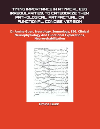 TIMING IMPORTANCE IN ATYPICAL EEG IRREGULARITIES, TO CATEGORIZE THEM PATHOLOGICAL, ARTIFACTUAL, OR FUNCTIONAL: CONCISE VERSION: Dr Amine Guen, ... Functional Explorations, Neurorehabilitation TIMING IMPORTANCE IN ATYPICAL EEG IRREGULARITIES, TO CATEGORIZE THEM PATHOLOGICAL, ARTIFACTUAL, OR FUNCTIONAL: CONCISE VERSION: Dr Amine Guen, ... Functional Explorations, Neurorehabilitation von Independently published