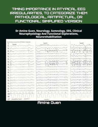 TIMING IMPORTANCE IN ATYPICAL EEG IRREGULARITIES, TO CATEGORIZE THEM PATHOLOGICAL, ARTIFACTUAL, OR FUNCTIONAL: SIMPLIFIED VERSION: Dr Amine Guen, ... Functional Explorations, Neurorehabilitation TIMING IMPORTANCE IN ATYPICAL EEG IRREGULARITIES, TO CATEGORIZE THEM PATHOLOGICAL, ARTIFACTUAL, OR FUNCTIONAL: SIMPLIFIED VERSION: Dr Amine Guen, ... Functional Explorations, Neurorehabilitation von Independently published