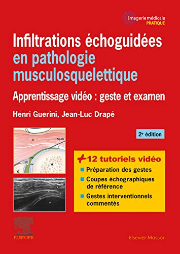 Infiltrations échoguidées en pathologie musculosquelettique: Apprentissage vidéo : geste et examen von Elsevier Masson