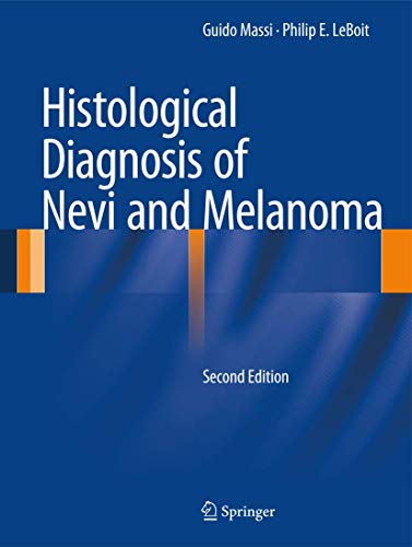 Histological Diagnosis of Nevi and Melanoma von Springer