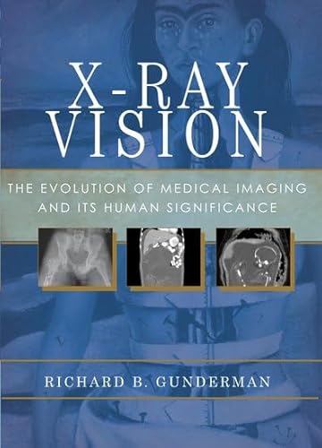 X-Ray Vision: The Evolution of Medical Imaging and Its Human Significance