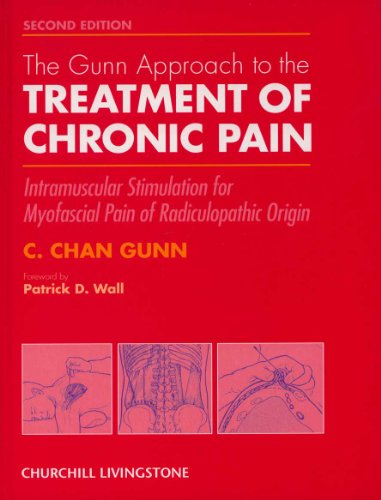 The Gunn Approach to the Treatment of Chronic Pain: Intramuscular Stimulation for Myofascial Pain of Radiculopathic Origin