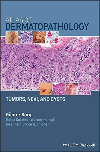 Atlas of Dermatopathology: Tumors, Nevi, and Cysts von Wiley-Blackwell
