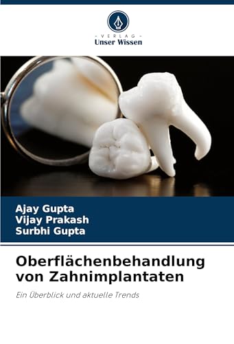 Oberflächenbehandlung von Zahnimplantaten: Ein Überblick und aktuelle Trends von Verlag Unser Wissen