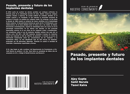 Pasado, presente y futuro de los implantes dentales von Ediciones Nuestro Conocimiento
