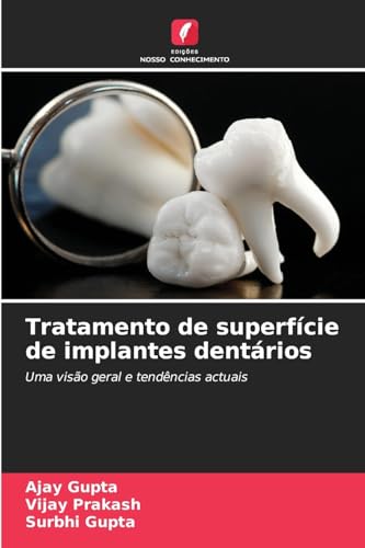 Tratamento de superfície de implantes dentários: Uma visão geral e tendências actuais von Edições Nosso Conhecimento