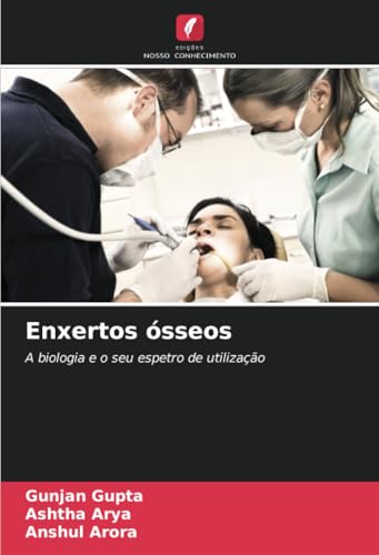 Enxertos ósseos: A biologia e o seu espetro de utilização von Edições Nosso Conhecimento