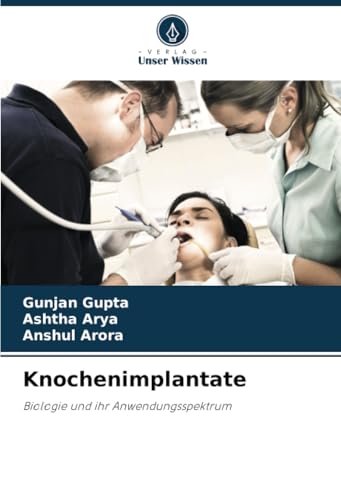 Knochenimplantate: Biologie und ihr Anwendungsspektrum von Verlag Unser Wissen