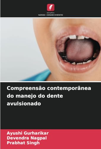 Compreensão contemporânea do manejo do dente avulsionado von Edições Nosso Conhecimento