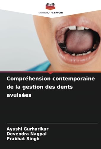 Compréhension contemporaine de la gestion des dents avulsées von Editions Notre Savoir
