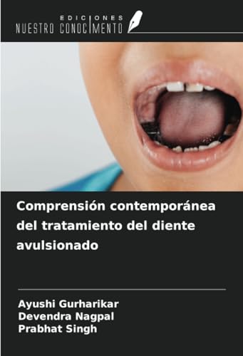 Comprensión contemporánea del tratamiento del diente avulsionado von Ediciones Nuestro Conocimiento