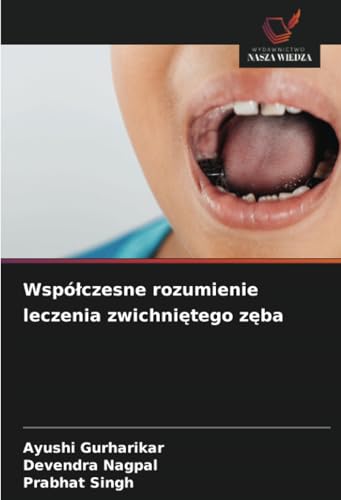 Współczesne rozumienie leczenia zwichniętego zęba: DE von Wydawnictwo Nasza Wiedza