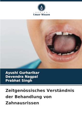 Zeitgenössisches Verständnis der Behandlung von Zahnausrissen von Verlag Unser Wissen